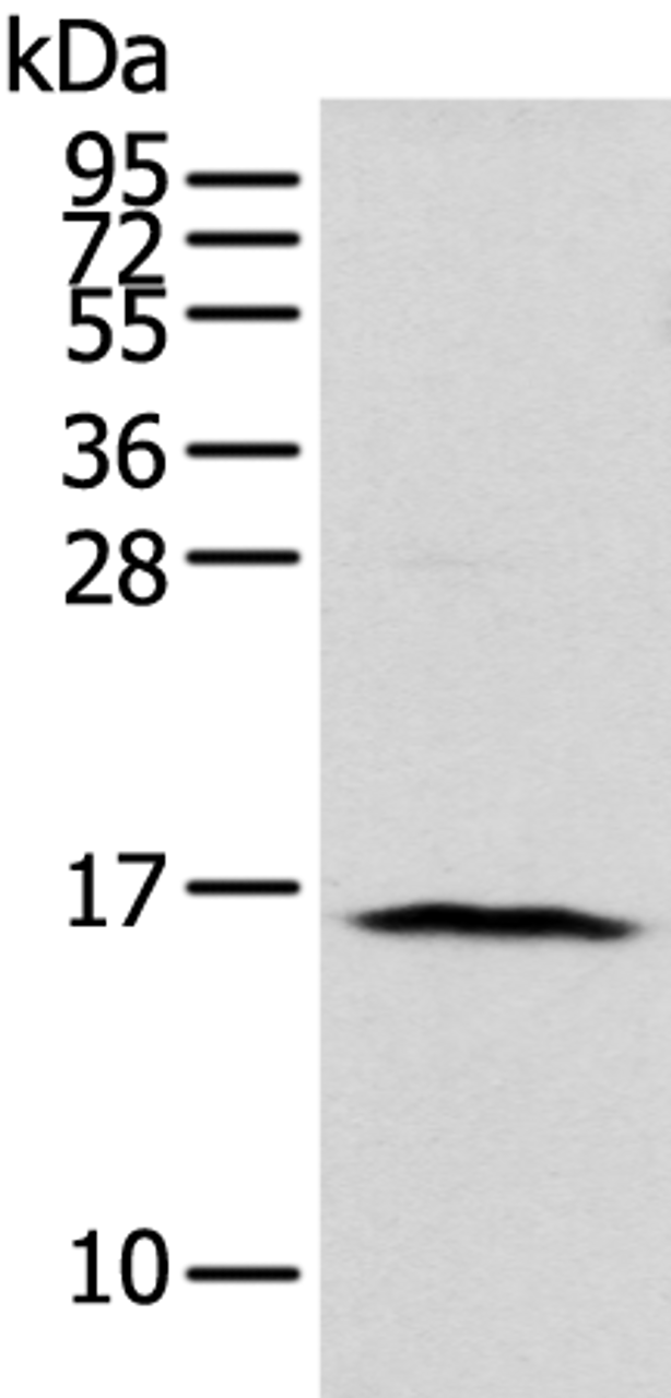 Western blot analysis of 293T cell  using NUDT10 Polyclonal Antibody at dilution of 1:800