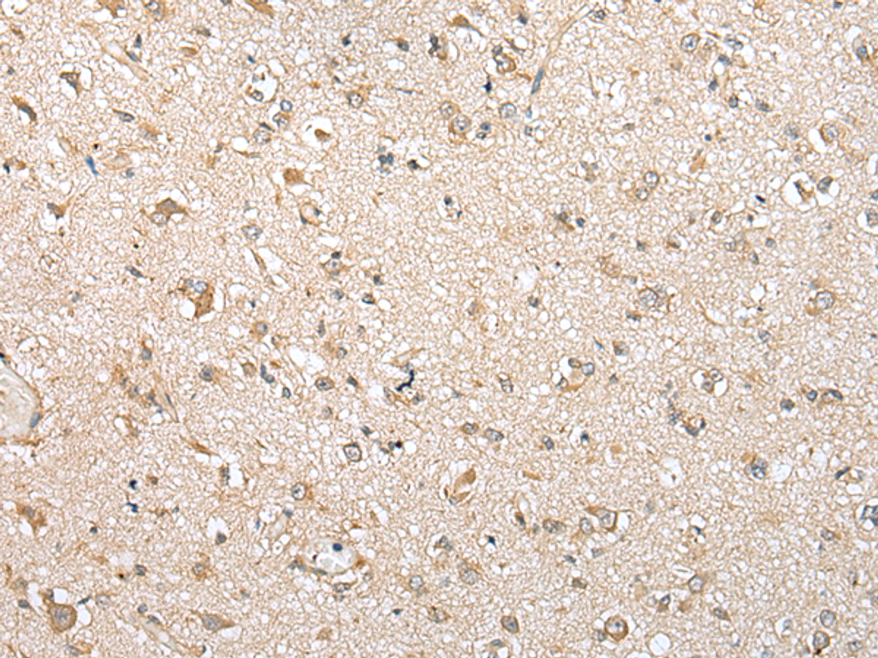 Immunohistochemistry of paraffin-embedded Human brain tissue  using NUDT10 Polyclonal Antibody at dilution of 1:70(×200)