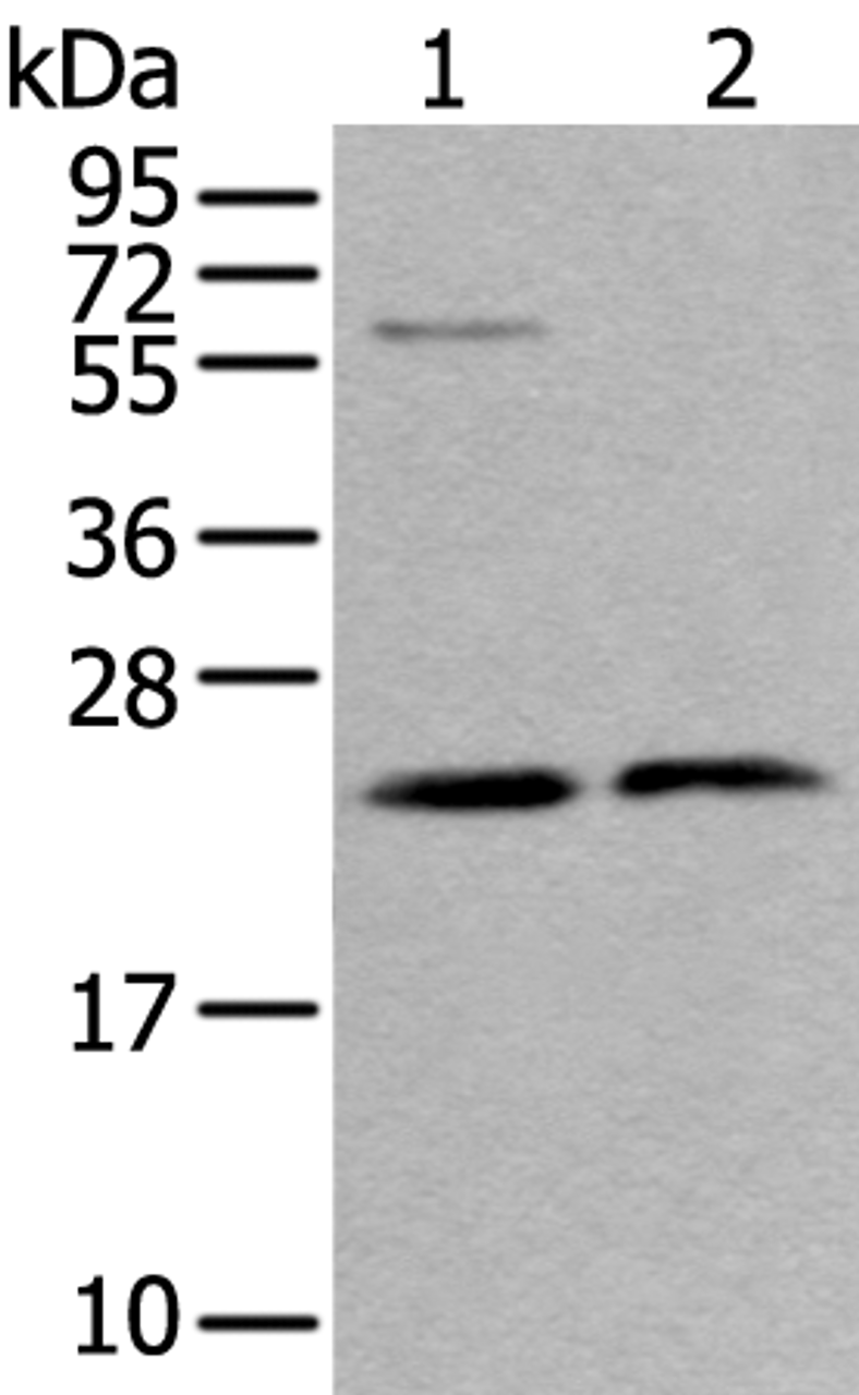 Western blot analysis of LO2 cell and Human testis tissue lysates  using ABHD14B Polyclonal Antibody at dilution of 1:350