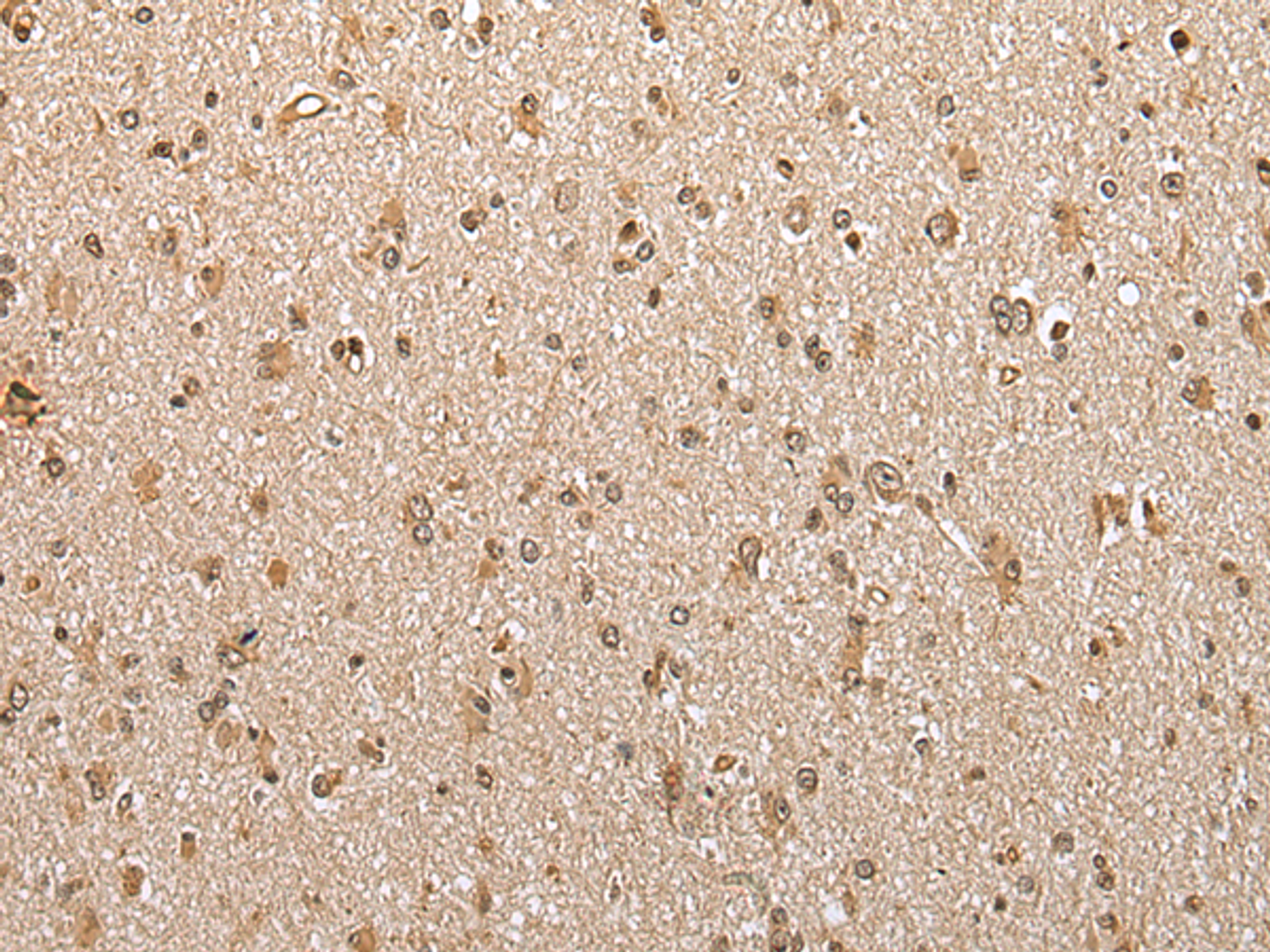 Immunohistochemistry of paraffin-embedded Human brain tissue  using ABHD14B Polyclonal Antibody at dilution of 1:30(×200)