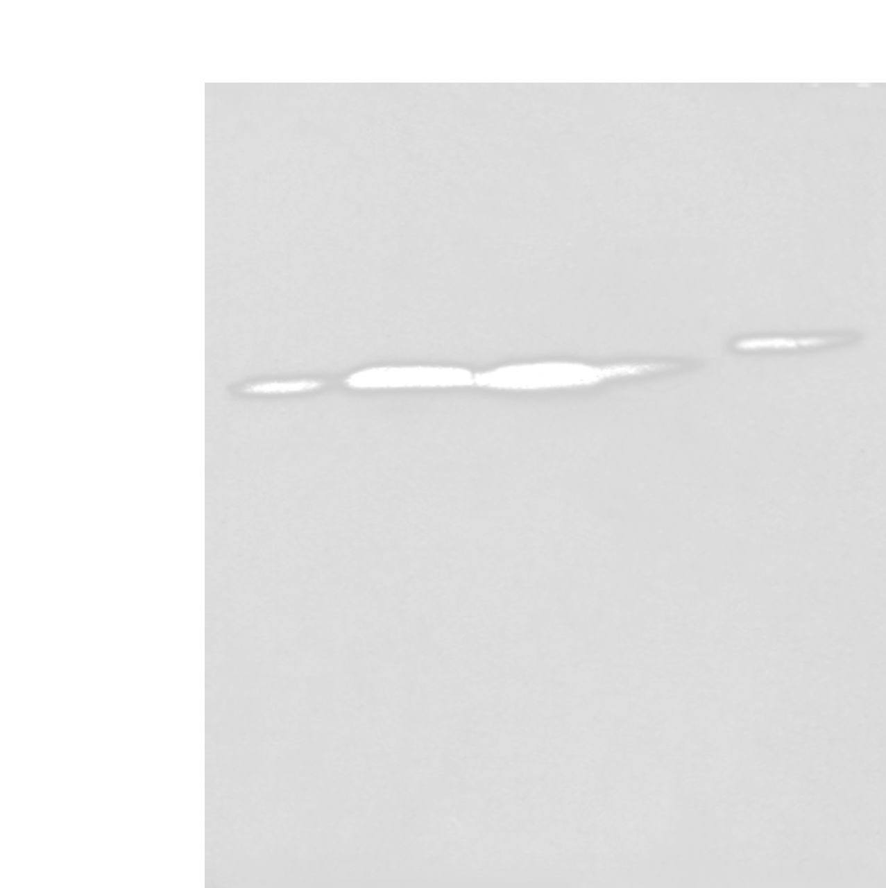 Western blot analysis of 293T cell Human fetal liver tissue A549 and Hepg2 cell  using FKBP7 Polyclonal Antibody at dilution of 1:400