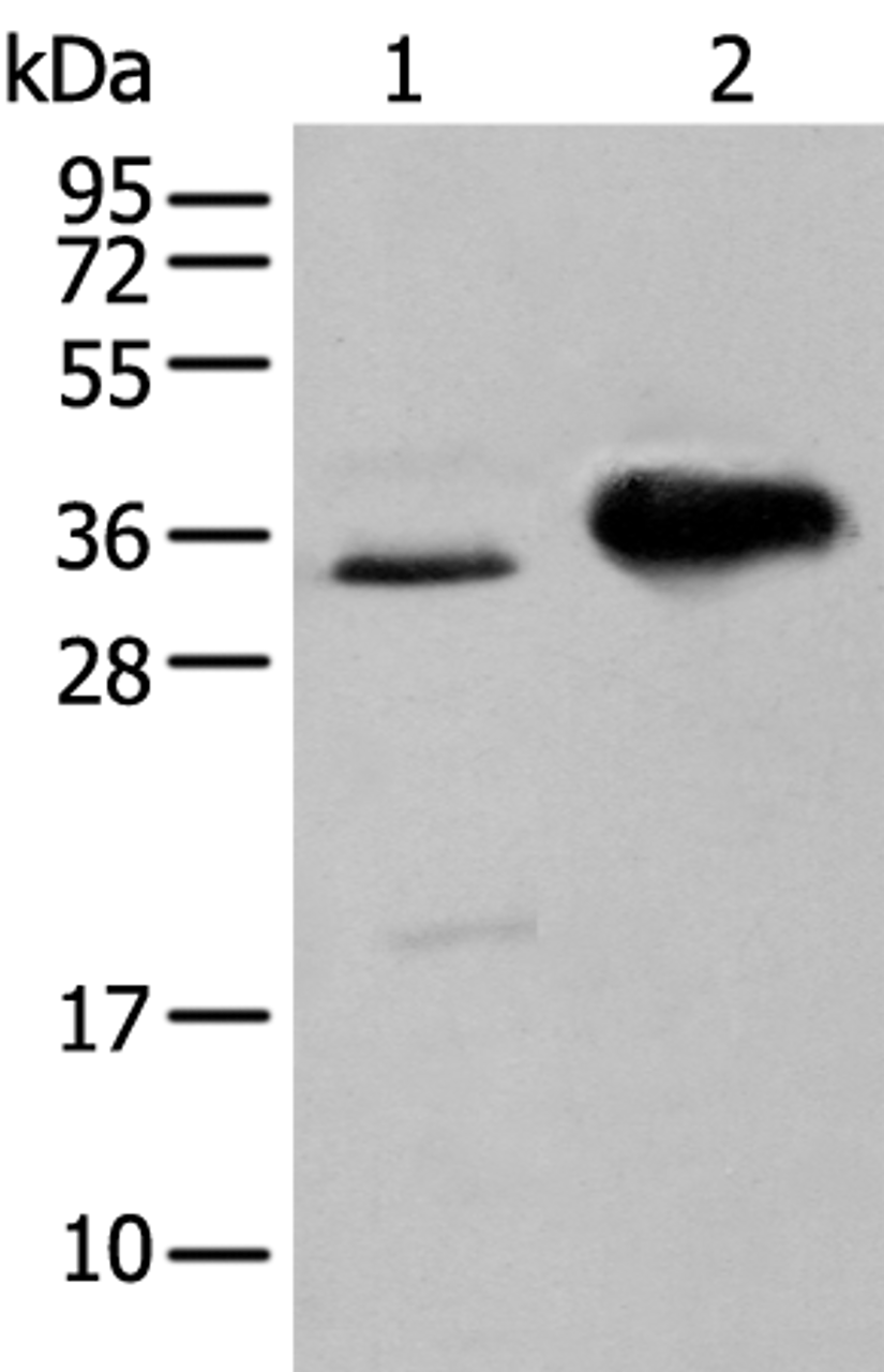 Western blot analysis of TM4 cell and Mouse brain tissue  using ATP6V1E2 Polyclonal Antibody at dilution of 1:400