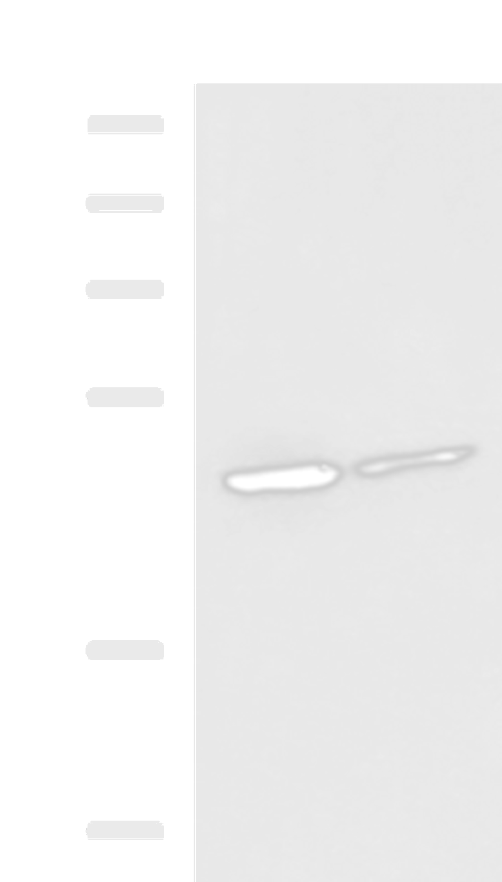 Western blot analysis of Jurkat and HepG2 cell lysates  using LRRC28 Polyclonal Antibody at dilution of 1:1000