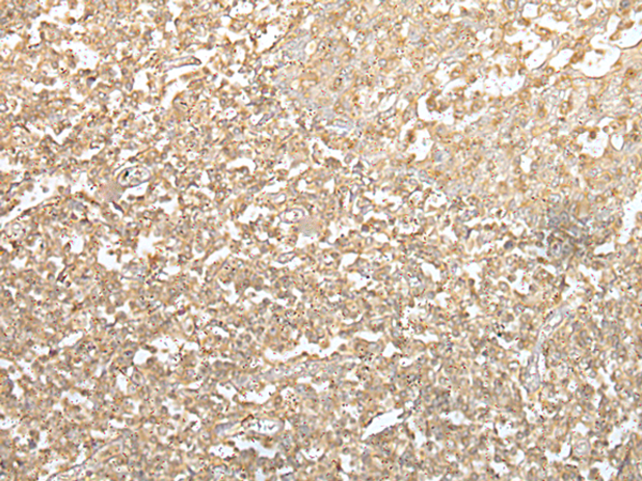 Immunohistochemistry of paraffin-embedded Human tonsil tissue  using SPIC Polyclonal Antibody at dilution of 1:55(×200)