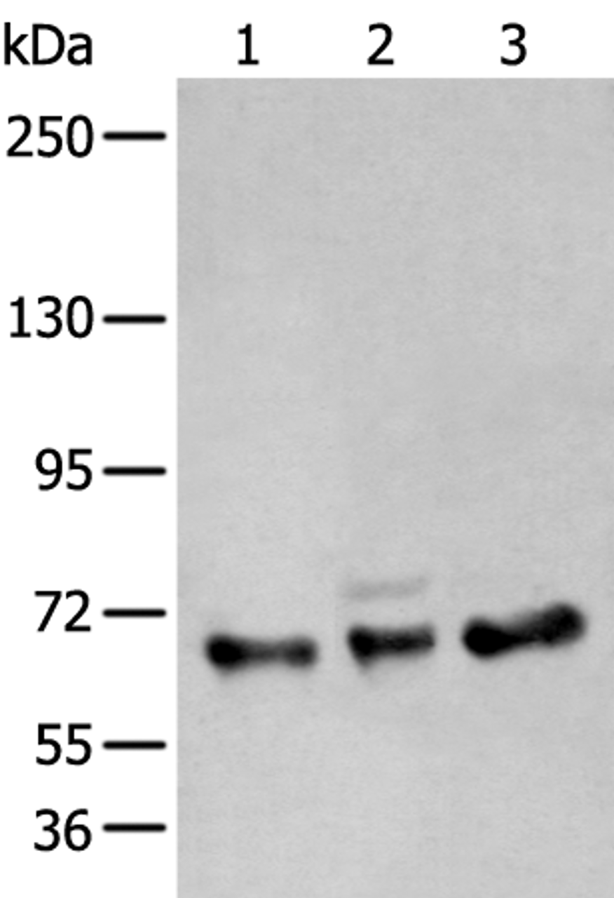 Western blot analysis of A431 K562 and TM4 cell lysates  using ZBTB5 Polyclonal Antibody at dilution of 1:400
