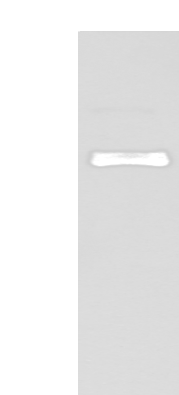Western blot analysis of A549 cell  using ZNF281 Polyclonal Antibody at dilution of 1:250