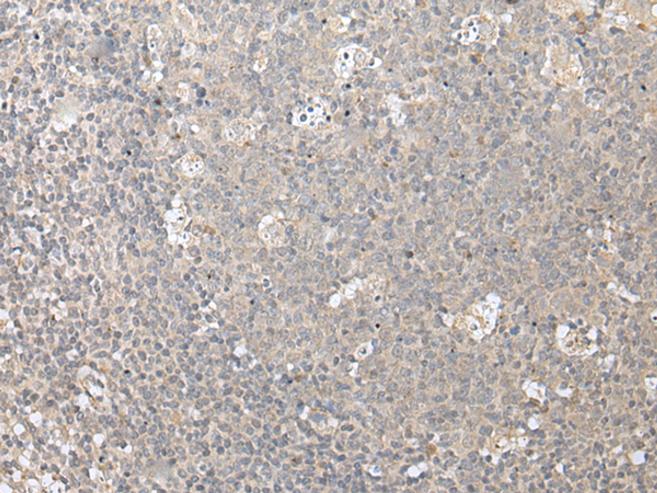 Immunohistochemistry of paraffin-embedded Human tonsil tissue  using ZFYVE1 Polyclonal Antibody at dilution of 1:40(×200)