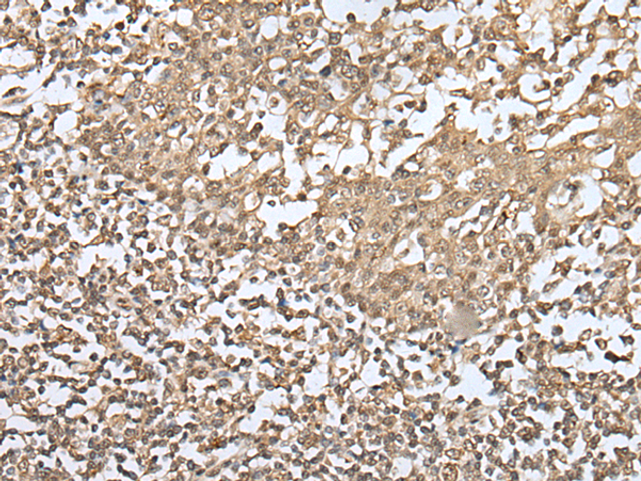 Immunohistochemistry of paraffin-embedded Human tonsil tissue  using ZKSCAN1 Polyclonal Antibody at dilution of 1:30(×200)