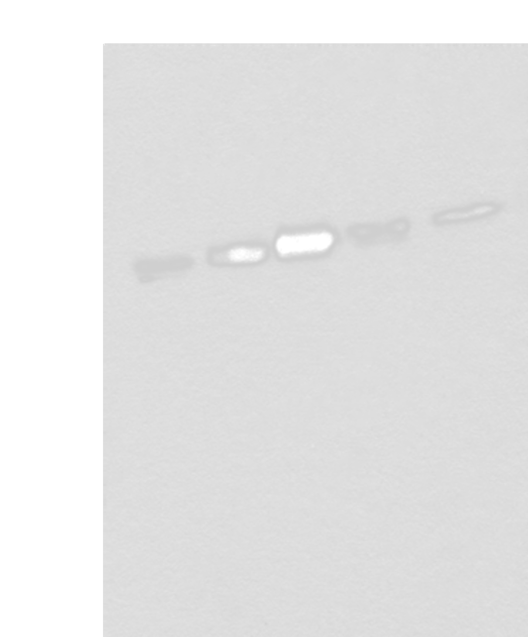 Western blot analysis of Hela HEPG2 231 A431 and Jurkat cell lysates  using ZPR1 Polyclonal Antibody at dilution of 1:400