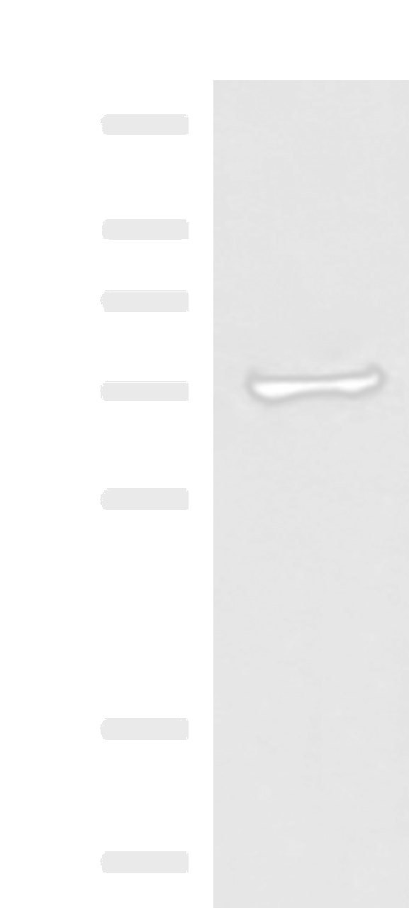 Western blot analysis of Human liver tissue lysate  using ZNF263 Polyclonal Antibody at dilution of 1:500