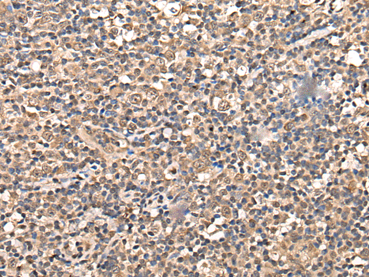 Immunohistochemistry of paraffin-embedded Human tonsil tissue  using ZSCAN12 Polyclonal Antibody at dilution of 1:50(×200)