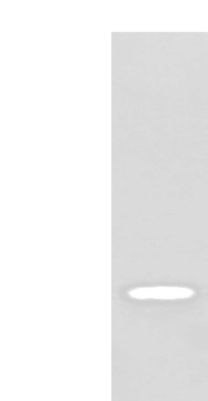 Western blot analysis of Human testis tissue lysate  using ZPBP Polyclonal Antibody at dilution of 1:250