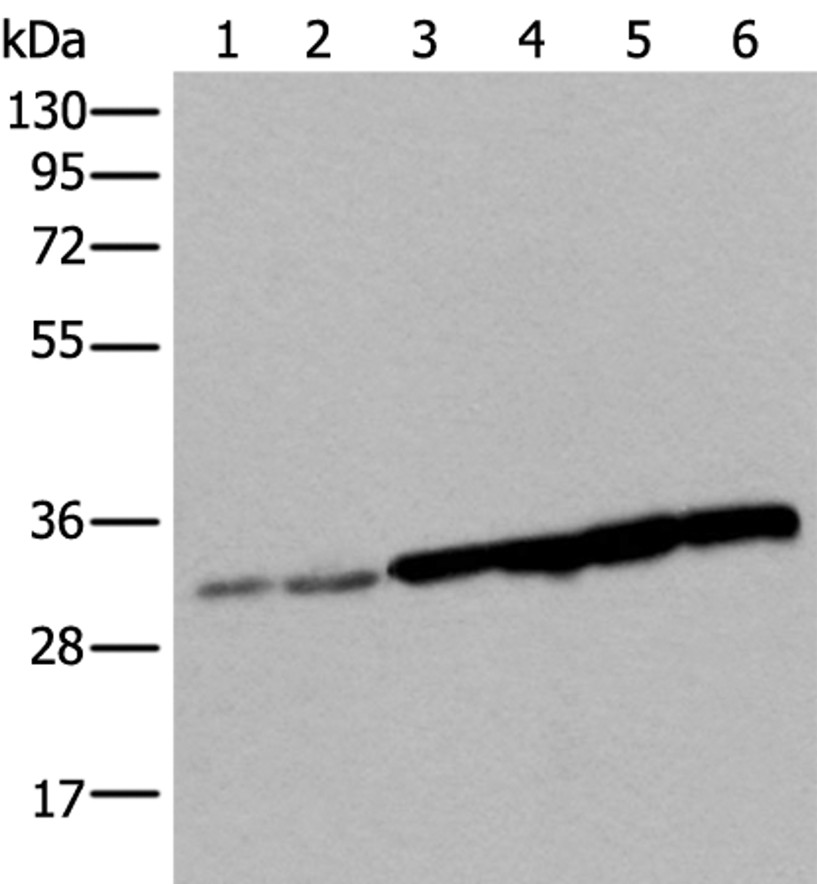 Western blot analysis of 293T cell Hela cell HEPG2 cell and A549 cell lysates  using SNRPA Polyclonal Antibody at dilution of 1:250