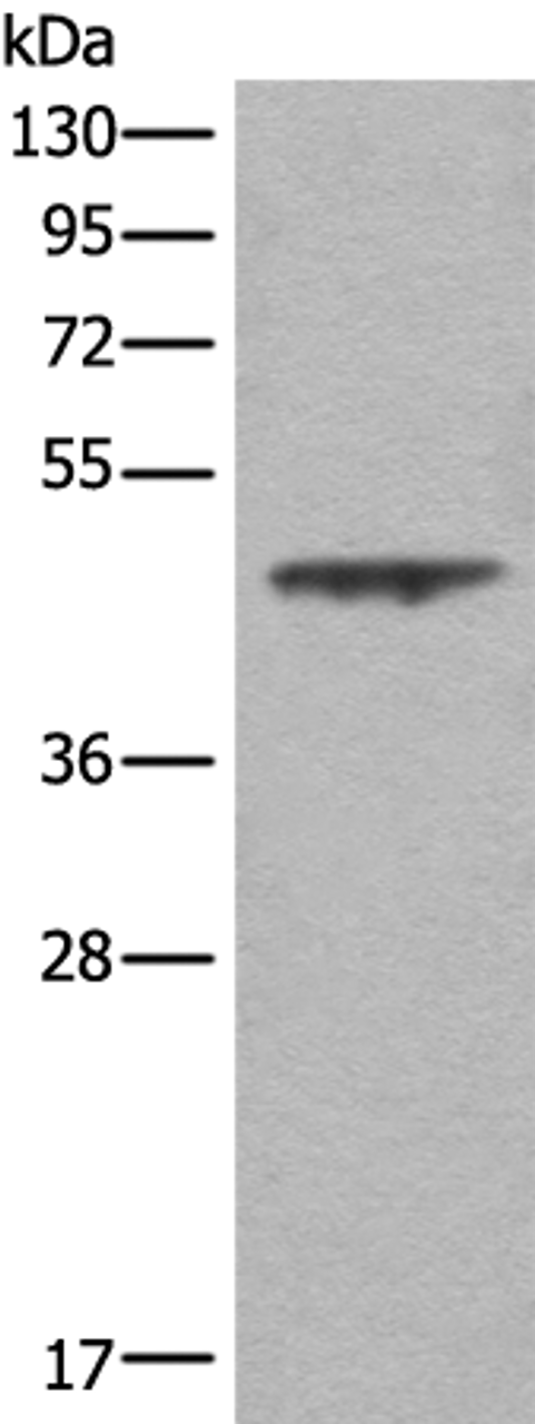 Western blot analysis of A431 cell lysate  using ASS1 Polyclonal Antibody at dilution of 1:350