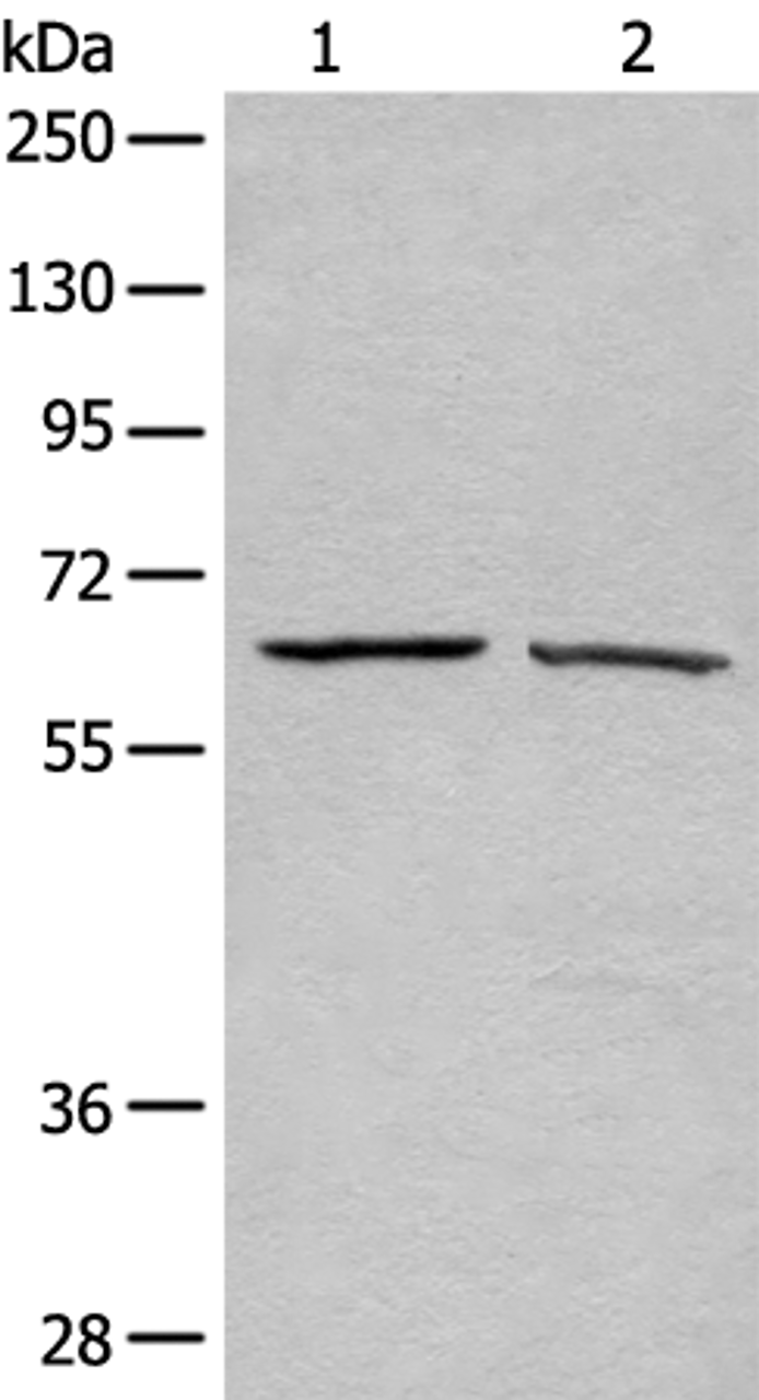 Western blot analysis of A431 and Hela cell lysates  using ATAD3A Polyclonal Antibody at dilution of 1:500