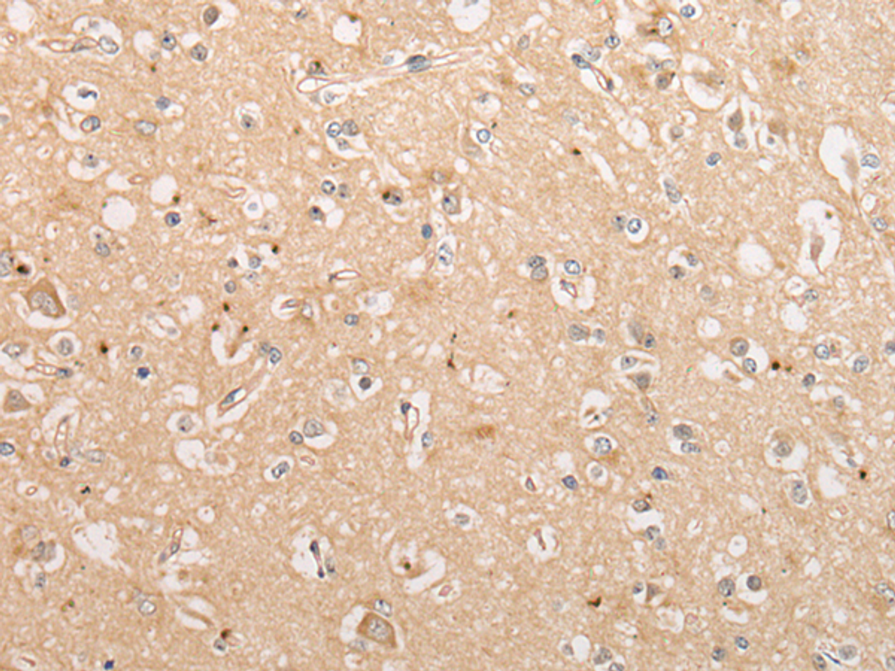 Immunohistochemistry of paraffin-embedded Human brain tissue  using C15orf40 Polyclonal Antibody at dilution of 1:30(×200)