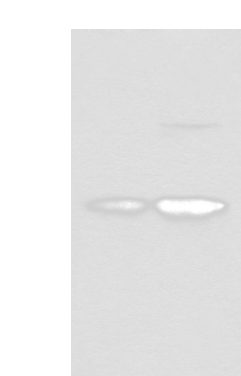 Western blot analysis of HL-60 and HEPG2 cell lysates  using COA7 Polyclonal Antibody at dilution of 1:550