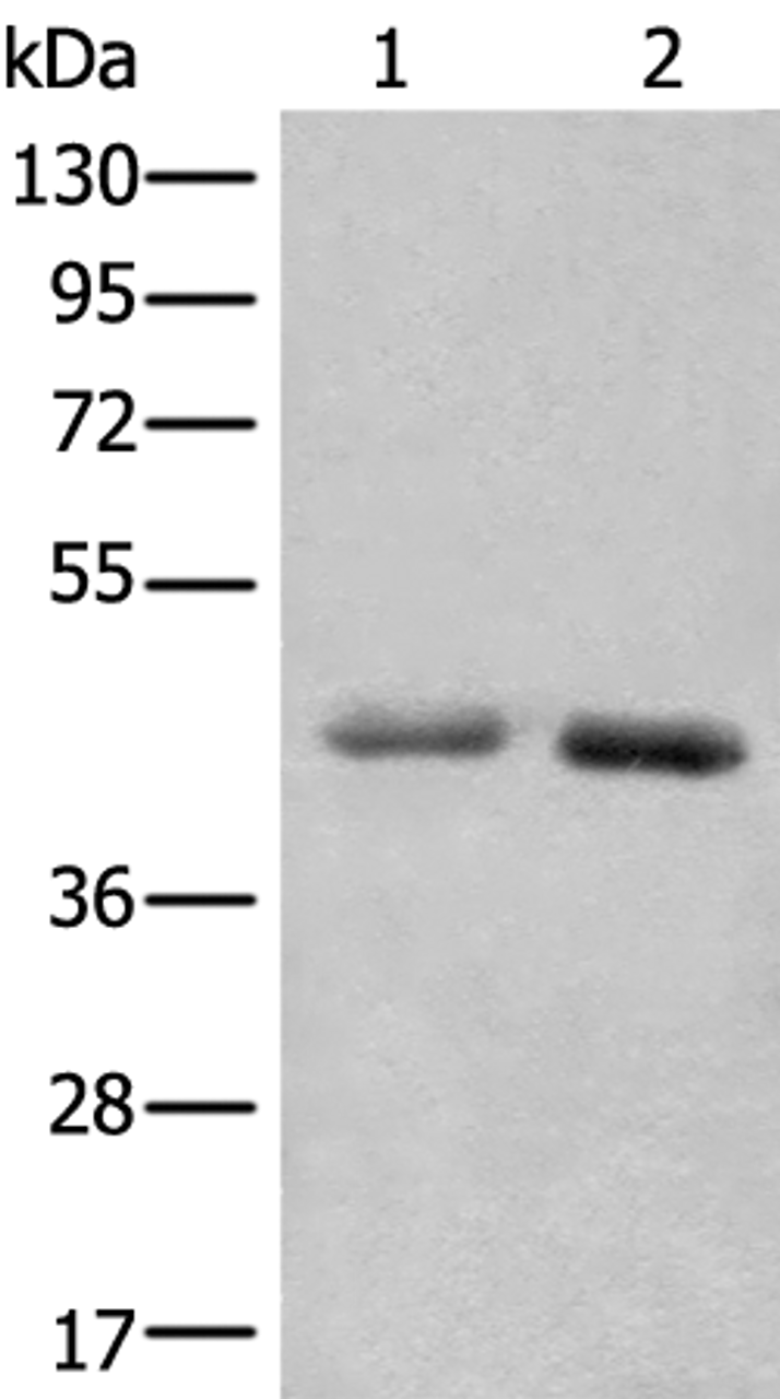 Western blot analysis of A549 and Hela cell lysates  using NADK2 Polyclonal Antibody at dilution of 1:1000