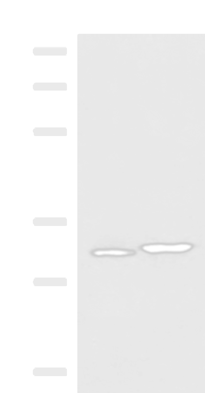 Western blot analysis of 293T cell lysates  using CBR3 Polyclonal Antibody at dilution of 1:800