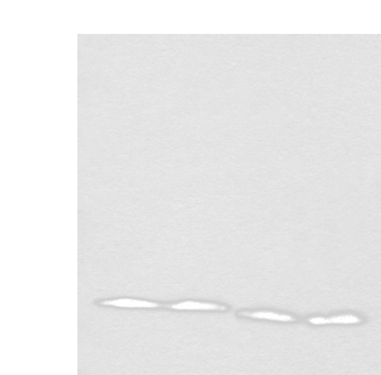 Western blot analysis of TM4 Jurkat NIH/3T3 and RAW264.7 cell lysates  using CETN3 Polyclonal Antibody at dilution of 1:600