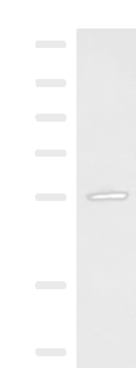 Western blot analysis of A549 cell lysate  using CEP57 Polyclonal Antibody at dilution of 1:600