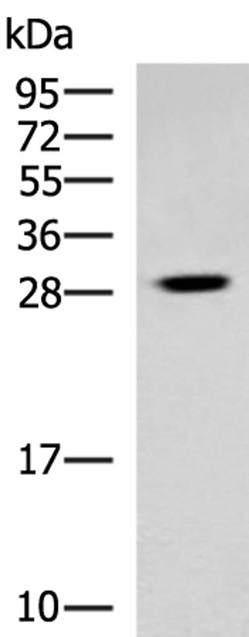 Western blot analysis of Human cerebrum tissue lysate  using TBCB Polyclonal Antibody at dilution of 1:800