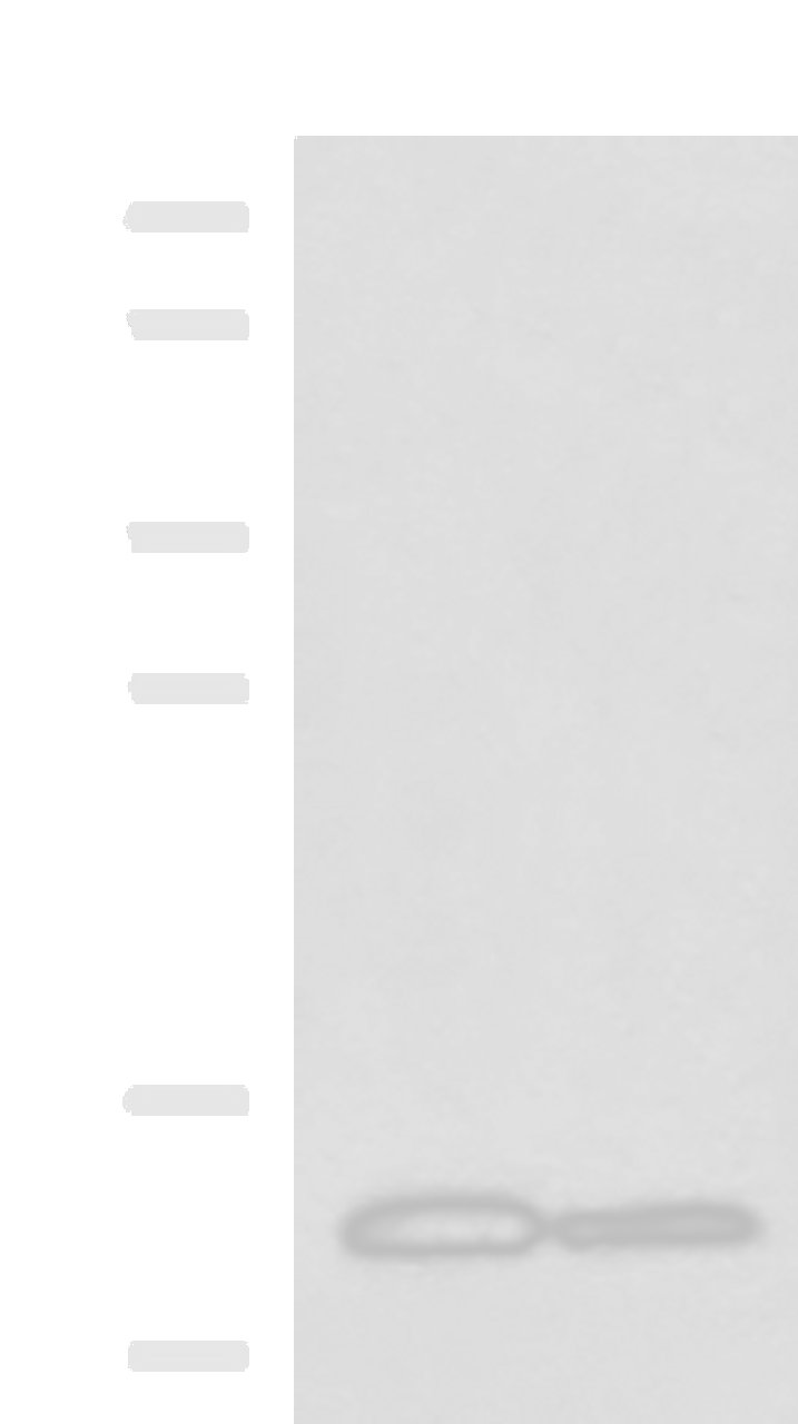 Western blot analysis of Human breast tissue and Human thyroid tissue lysates  using CRABP1 Polyclonal Antibody at dilution of 1:2000