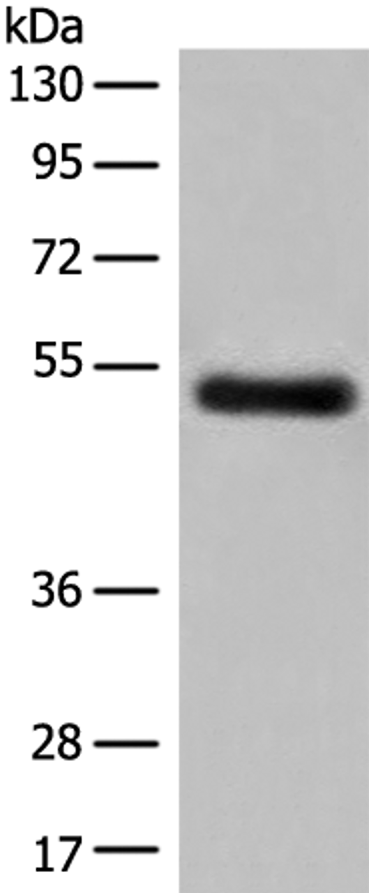 Western blot analysis of Human breast cancer tissue lysate  using GK5 Polyclonal Antibody at dilution of 1:500