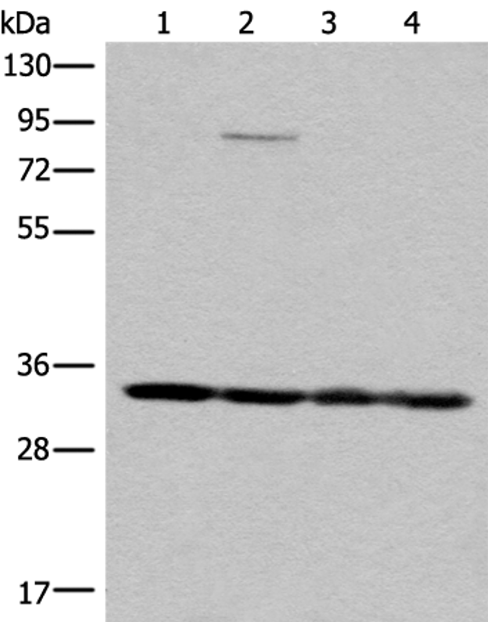 Western blot analysis of K562 HEPG2 231 and Jurkat cell lysates  using MRPL1 Polyclonal Antibody at dilution of 1:350