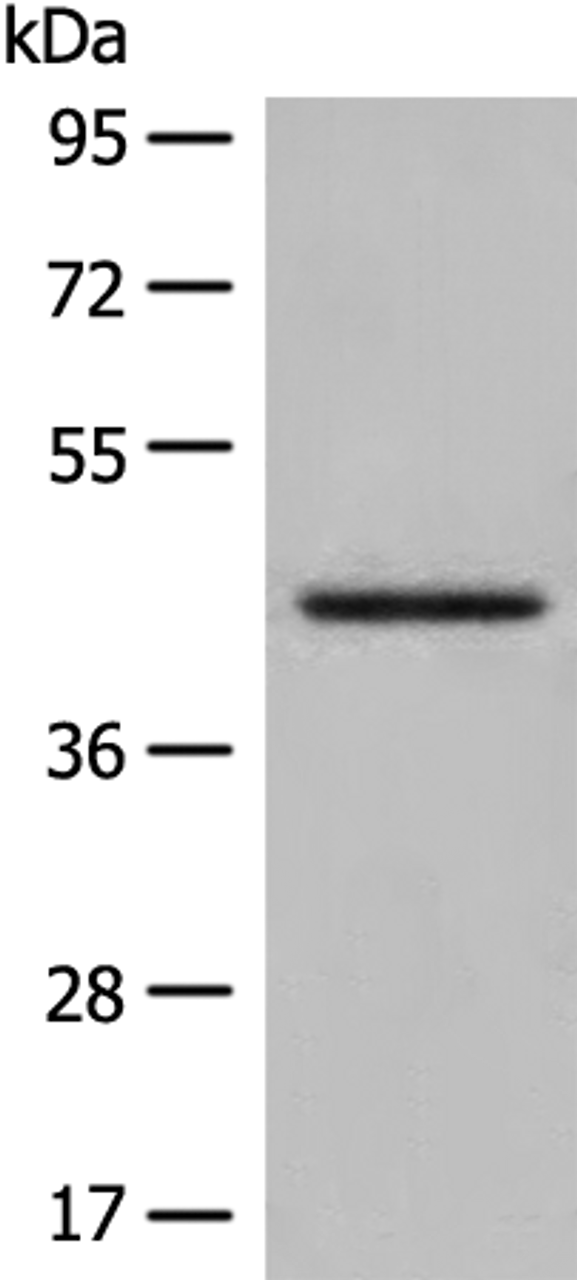 Western blot analysis of Human kidney tissue lysate  using DHRS7 Polyclonal Antibody at dilution of 1:400