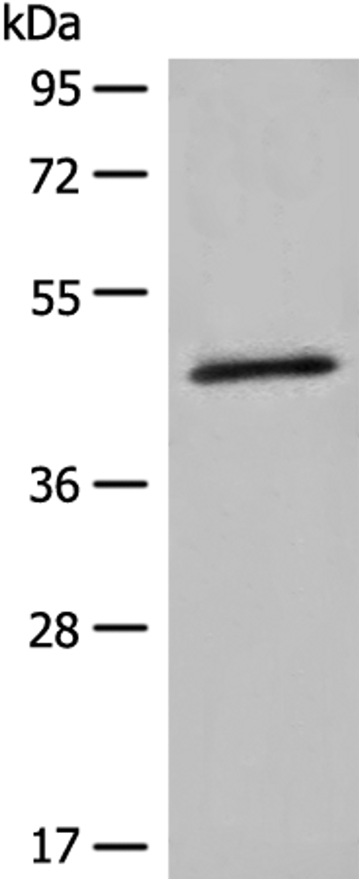 Western blot analysis of K562 cell lysate  using HMBS Polyclonal Antibody at dilution of 1:450
