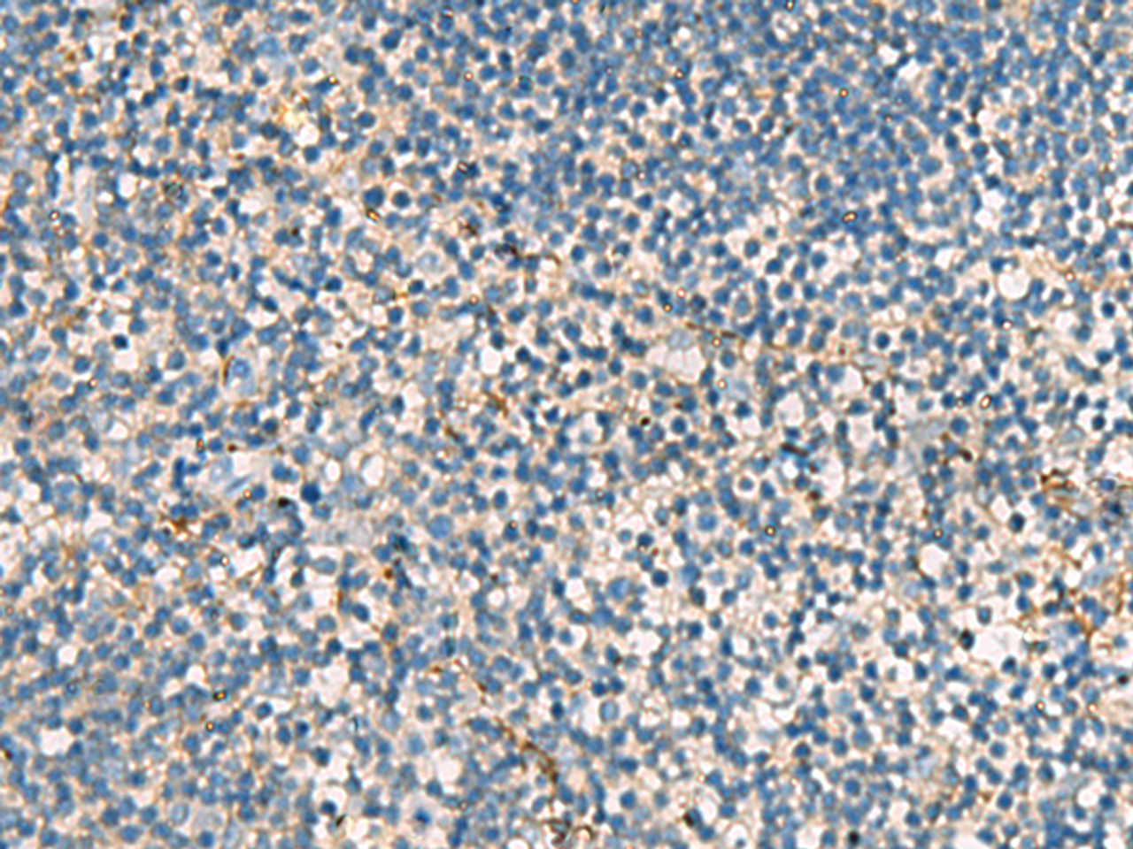 Immunohistochemistry of paraffin-embedded Human tonsil tissue  using ACTC1 Polyclonal Antibody at dilution of 1:55(×200)