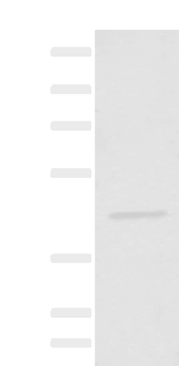 Western blot analysis of HEPG2 cell lysate  using HENMT1 Polyclonal Antibody at dilution of 1:500
