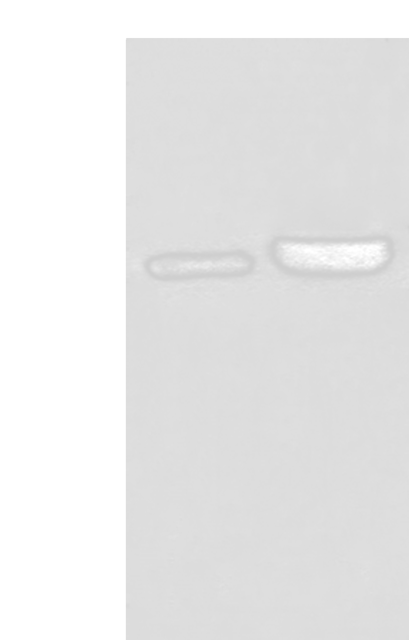 Western blot analysis of 231 cell and Human fetal liver tissue lysates  using INPP1 Polyclonal Antibody at dilution of 1:500