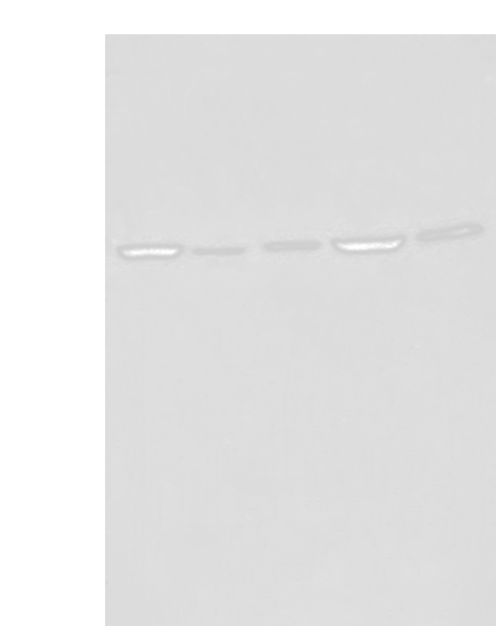 Western blot analysis of Raji Hela A549 HEPG2 and 231 cell lysates  using EIF4A3 Polyclonal Antibody at dilution of 1:500