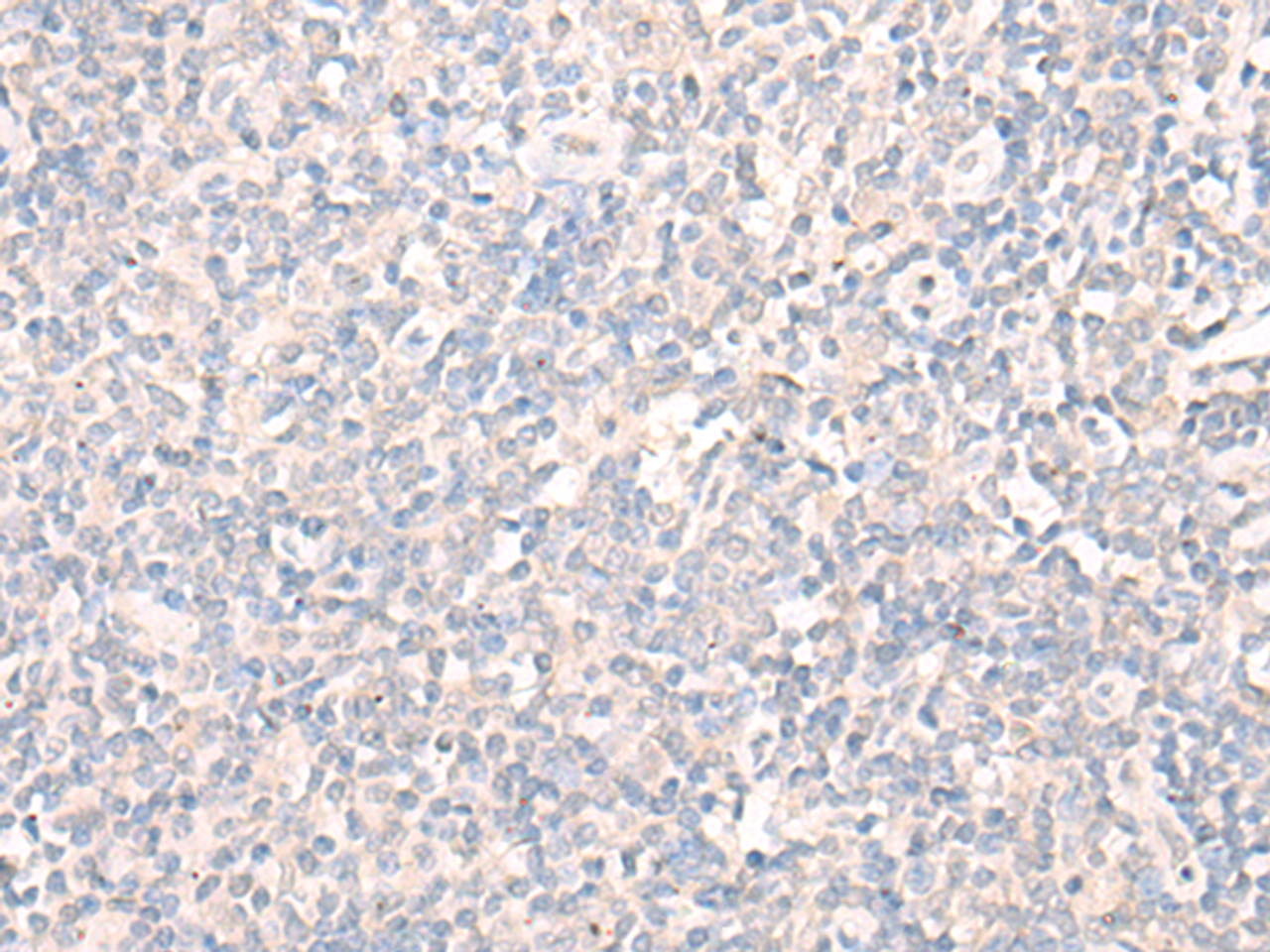Immunohistochemistry of paraffin-embedded Human tonsil tissue  using LILRA2 Polyclonal Antibody at dilution of 1:40(×200)
