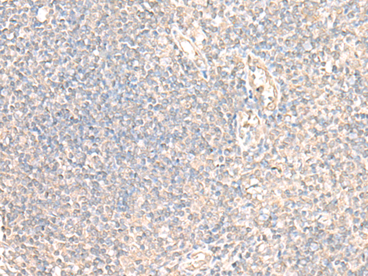 Immunohistochemistry of paraffin-embedded Human tonsil tissue  using PARS2 Polyclonal Antibody at dilution of 1:30(×200)