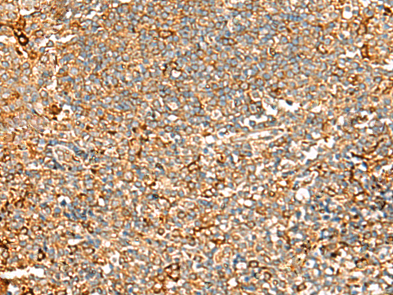 Immunohistochemistry of paraffin-embedded Human tonsil tissue  using ASMTL Polyclonal Antibody at dilution of 1:100(×200)