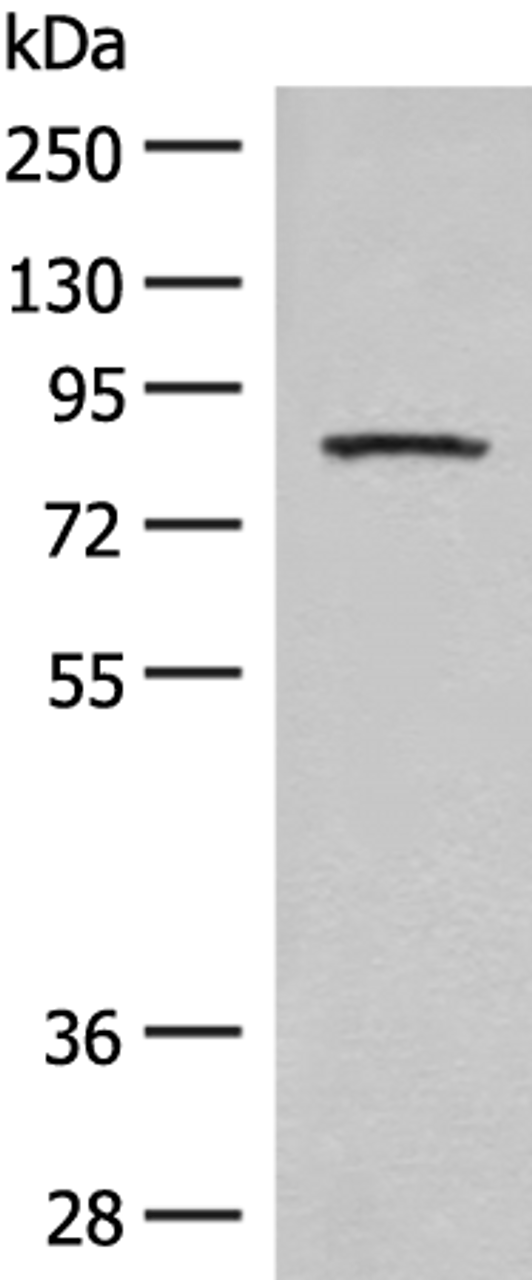Western blot analysis of Mouse brain tissue lysate  using PFKM Polyclonal Antibody at dilution of 1:350