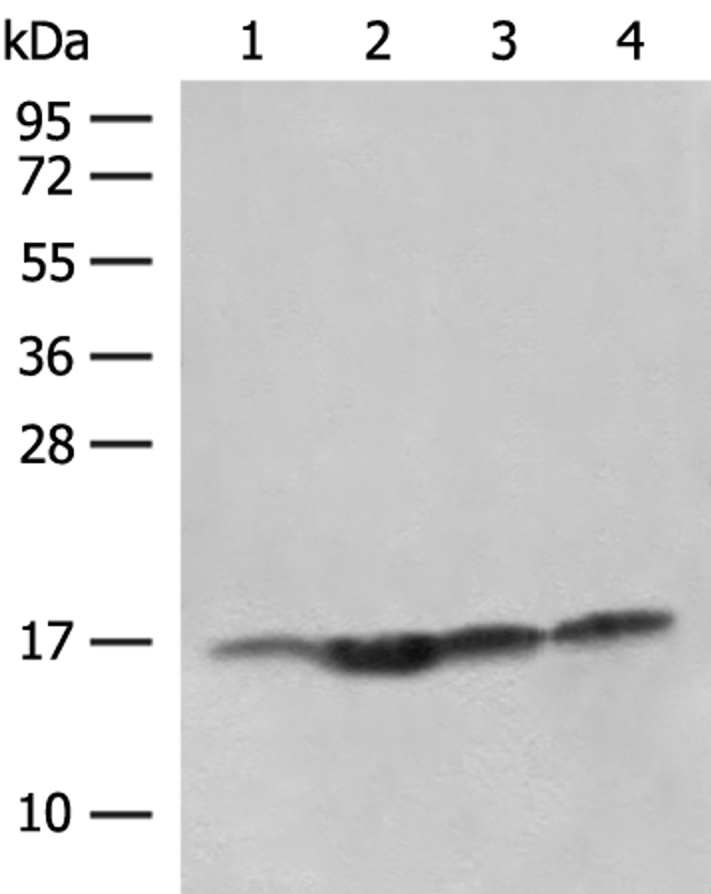 Western blot analysis of Human prostate tissue Jurkat cell Hela and HL-60 cell lysates  using MAGOHB Polyclonal Antibody at dilution of 1:400