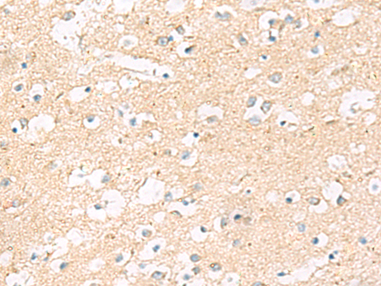 Immunohistochemistry of paraffin-embedded Human brain tissue  using MRPL20 Polyclonal Antibody at dilution of 1:60(×200)