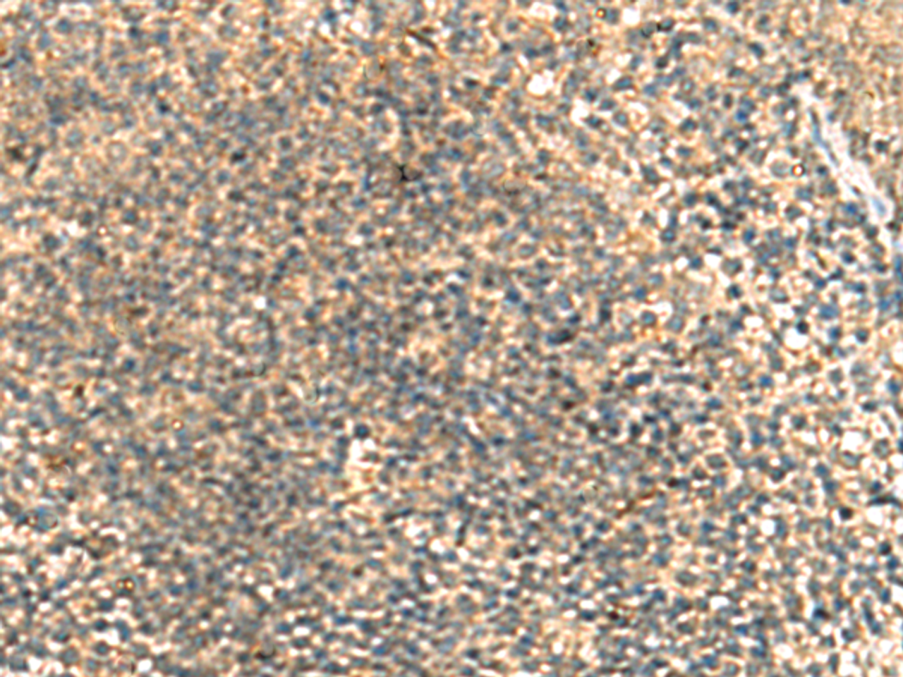 Immunohistochemistry of paraffin-embedded Human tonsil tissue  using TCAP Polyclonal Antibody at dilution of 1:55(×200)