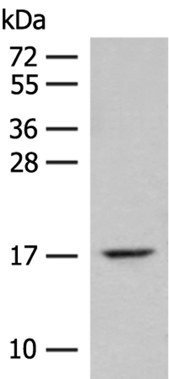 Western blot analysis of Mouse lung tissue lysate  using ISCU Polyclonal Antibody at dilution of 1:400