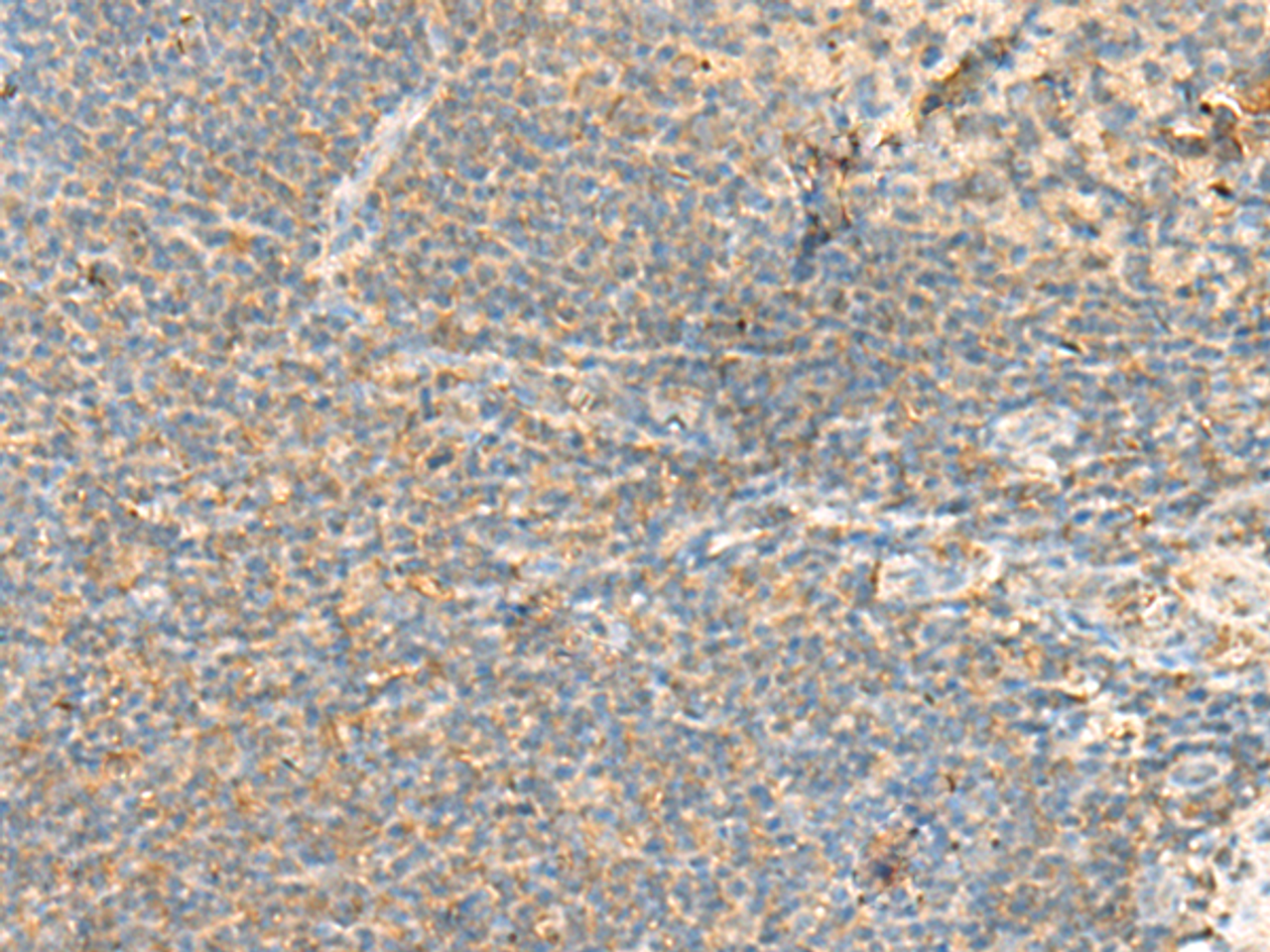 Immunohistochemistry of paraffin-embedded Human tonsil tissue  using RHOH Polyclonal Antibody at dilution of 1:90(×200)