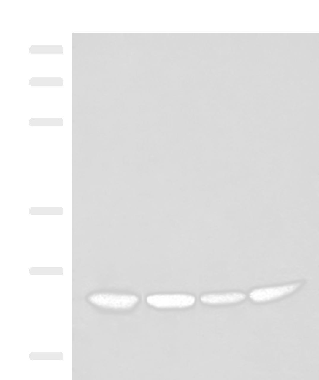 Western blot analysis of Human fetal liver tissue HepG2 K562 and Raji cell lysates  using DTYMK Polyclonal Antibody at dilution of 1:400