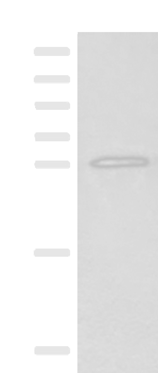 Western blot analysis of Mouse brain tissue lysate  using NIPSNAP3A Polyclonal Antibody at dilution of 1:550