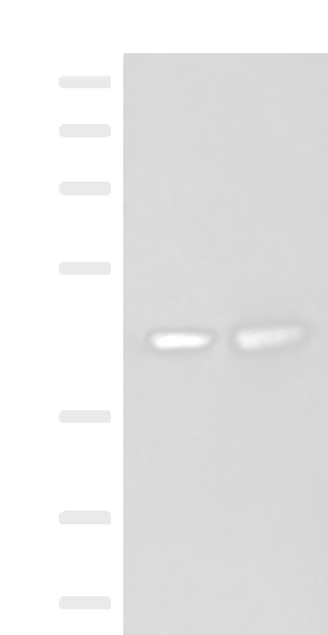 Western blot analysis of HepG2 and Hela cell lysates  using ORC4 Polyclonal Antibody at dilution of 1:550