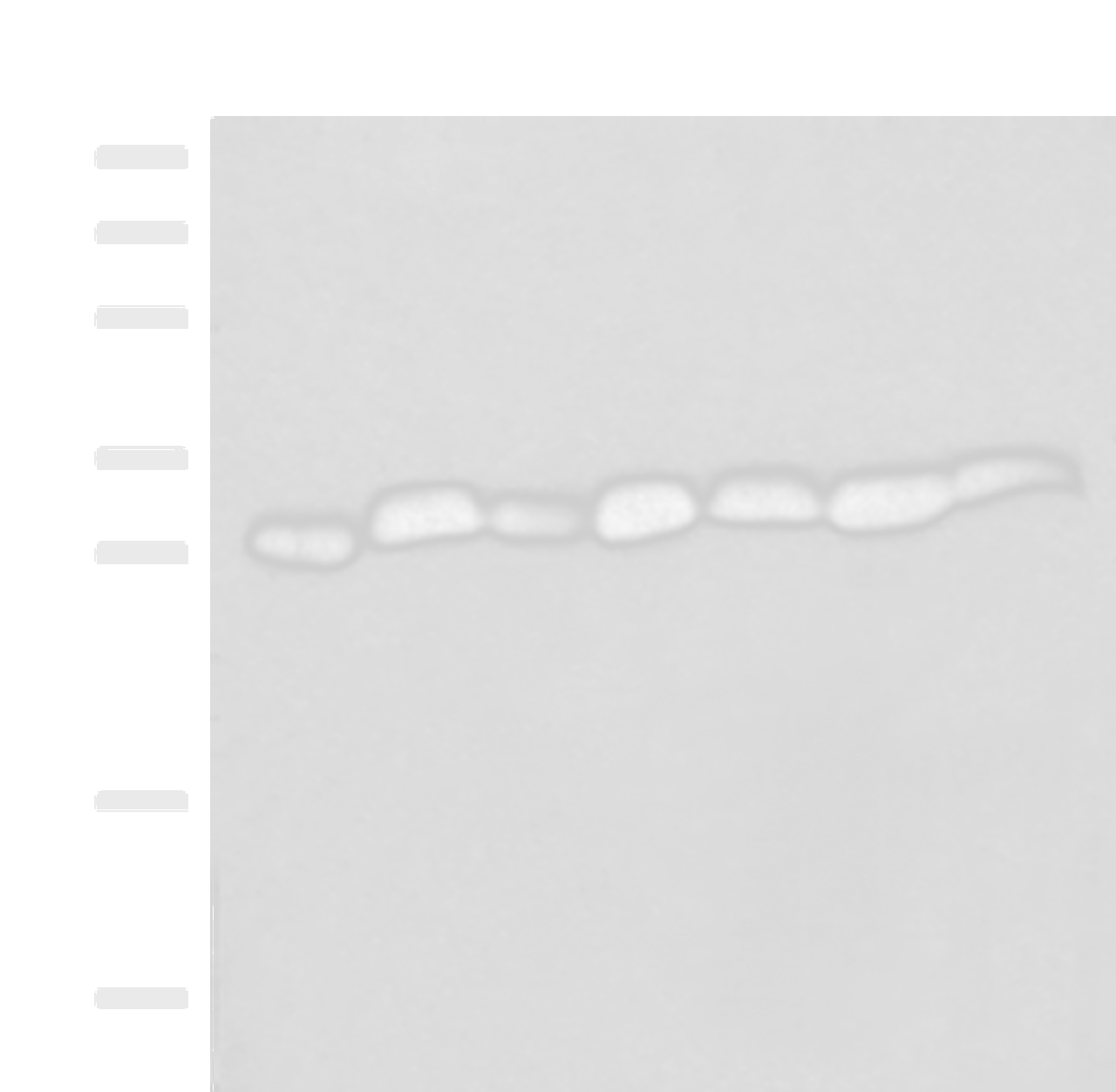 Western blot analysis of Hela cell Mouse spleen tissue Mouse liver tissue PC3 cell HL60 cell A549 cell NIH/3T3 cell lysates  using PSMA3 Polyclonal Antibody at dilution of 1:350