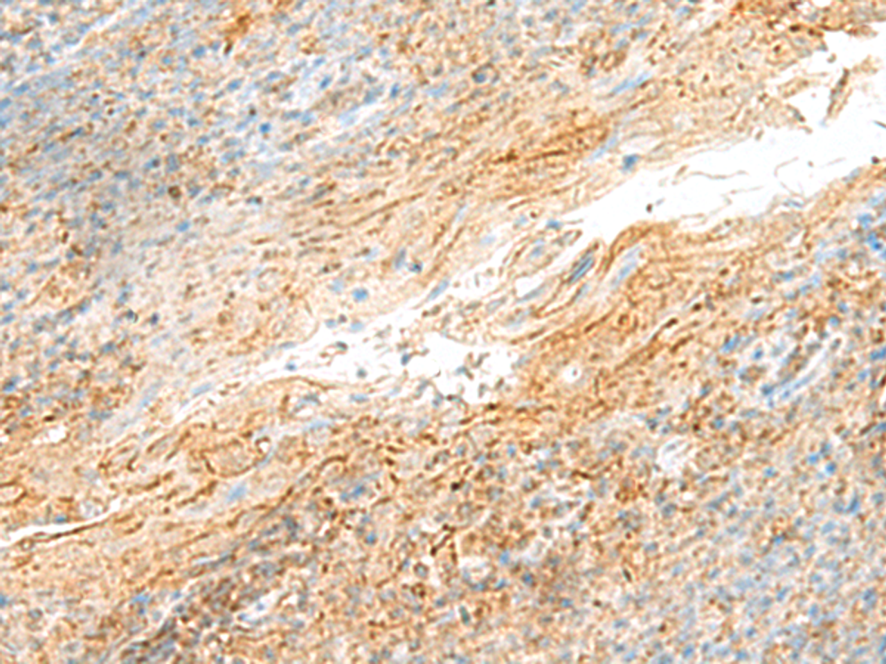Immunohistochemistry of paraffin-embedded Human tonsil tissue  using MRPS18B Polyclonal Antibody at dilution of 1:55(×200)