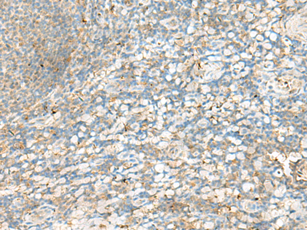 Immunohistochemistry of paraffin-embedded Human tonsil tissue  using HLA-DRB4 Polyclonal Antibody at dilution of 1:60(×200)